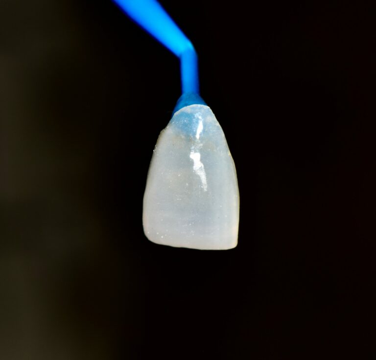 Faccette dentali dr Paccagnella